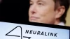 Beyond Science Fiction: Neuralink's Brain Implants Promise a Future of Enhanced Abilities